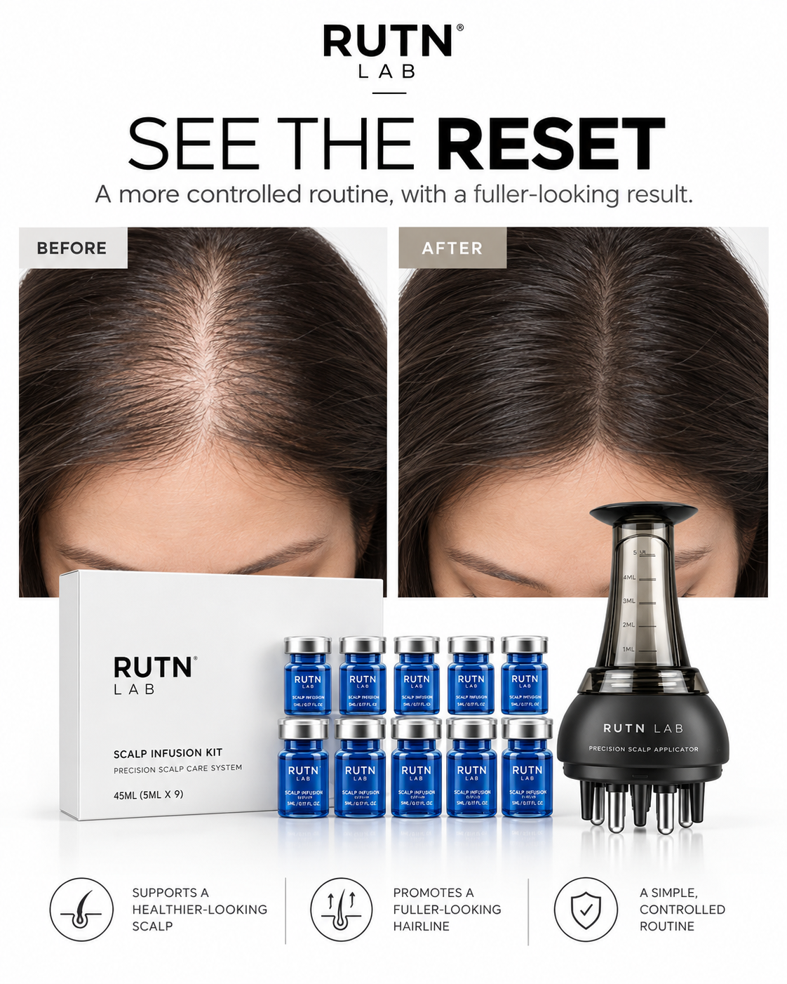 RUTN LAB before and after presentation